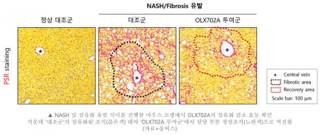 올릭스, 비알코올성 지방간염藥 동물실험서 효능 확인