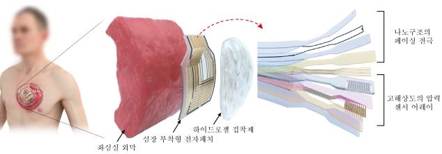 '돌연사 주범' 부정맥 실시간 진단·치료 전자 패치 개발