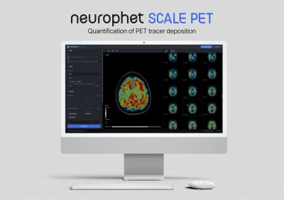 뉴로핏, 시범사업 통해 AI 뇌영상분석 소프트웨어 병원 공급