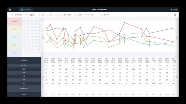 '뷰노메드 딥카스' 운영화면 예시. 