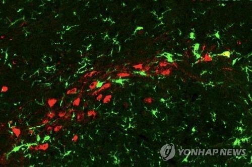 사랑의 감정은 어디에서 시작할까…심장일까, 뇌일까?