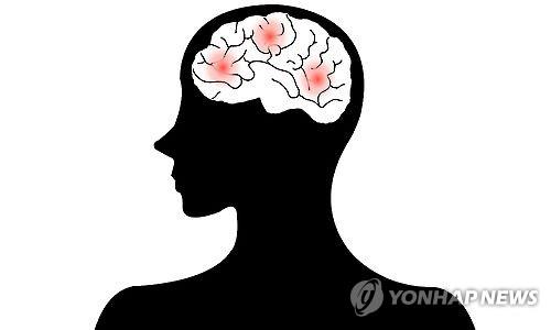 "뇌졸중 유전자 변이 89개 발굴…한국인 등 270만명 분석"