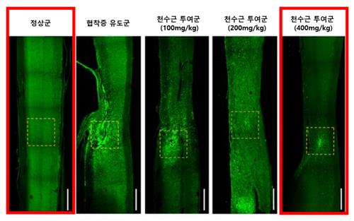 "한약재 천수근, 동물실험서 척추관협착증 치료 효과 확인"