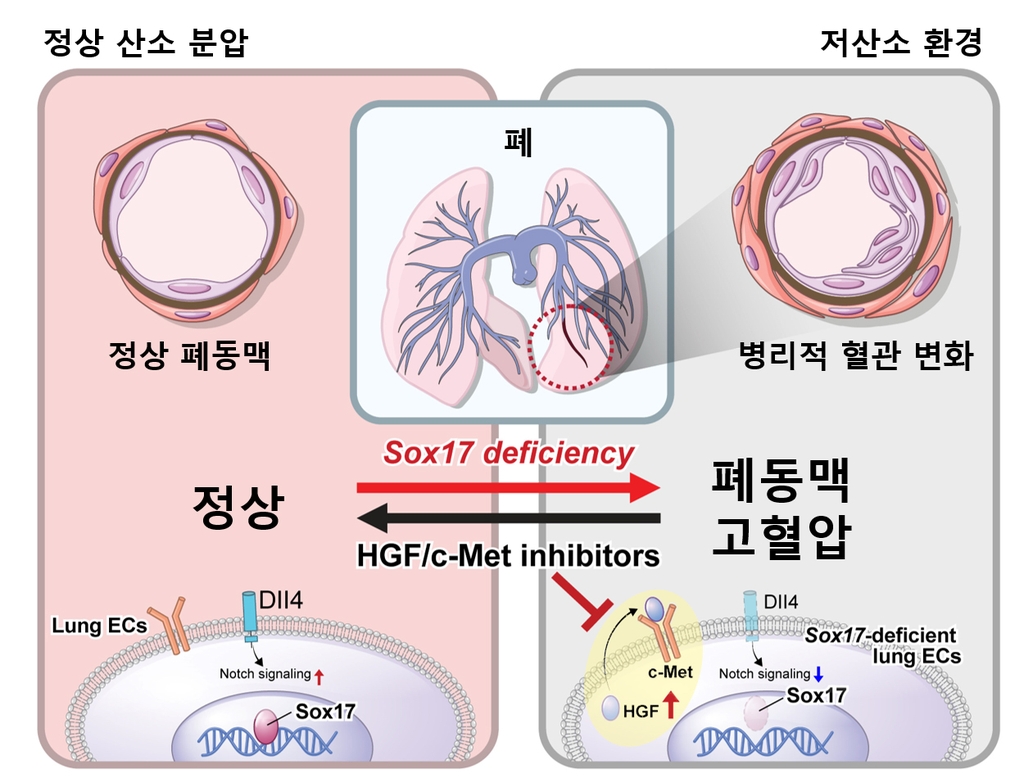 "돌연사 부르는 '폐동맥 고혈압' 유전자 메커니즘 규명"