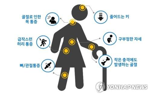 [위클리 건강] "중년여성의 적 골다공증, 심혈관질환도 부른다"