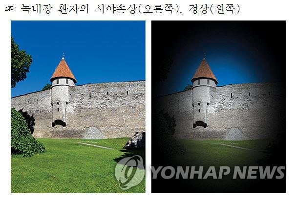 [위클리 건강] 서서히 시력 앗아가는 녹내장…내 눈 지키려면?