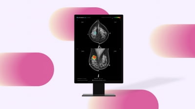 루닛 "호주 국영 유방암 검진 프로그램 운영권 단독 수주"