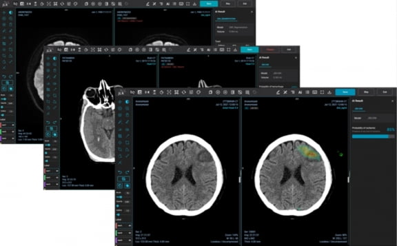 제이엘케이, ‘북미영상의학회’ 참가…뇌졸중 AI 솔루션 소개