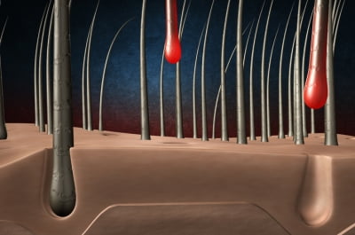 인벤티지랩 "장기지속형 탈모 주사제, 1·2상서 안정성 입증"
