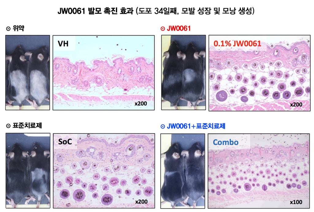 JW중외제약 "개발중 탈모치료제, 동물실험서 모발 성장 효과"