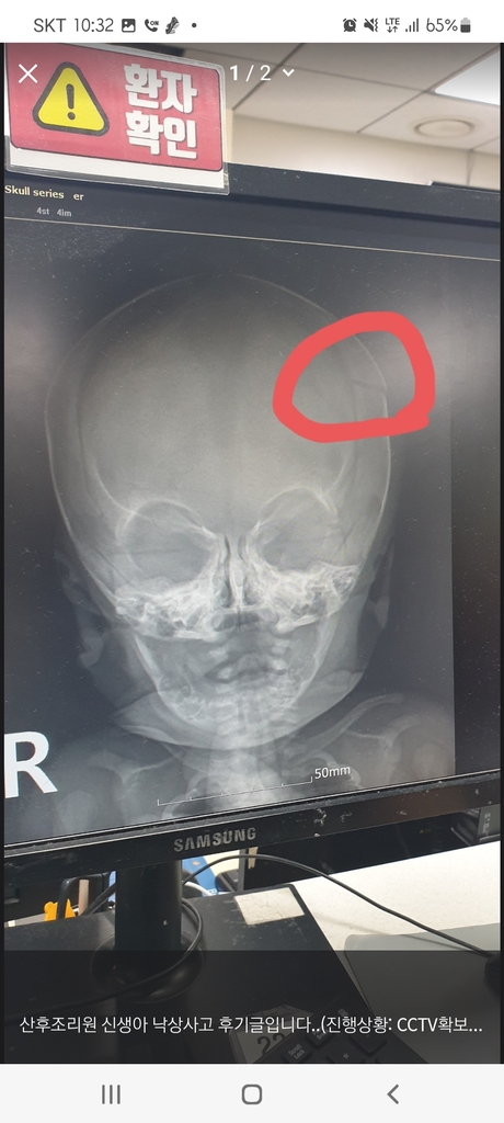 생후 13일 된 신생아 낙상사고 숨긴 조리원…경찰 수사