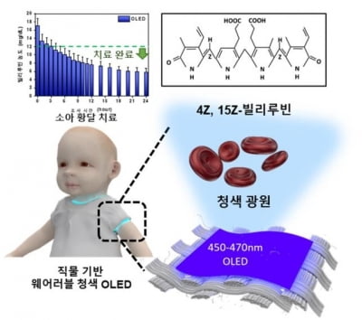 KAIST, 웨어러블 청색 OLED로 황달 치료…신생아 대상 효과 확인