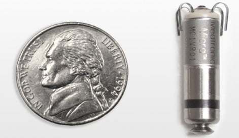 2016년 FDA가 승인한 동전 크기 미크라(Micra) 무선 심장박동기