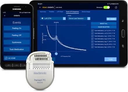 메드트로닉, 뇌 신호 감지 뇌심부자극기 '퍼셉트 PC' 출시