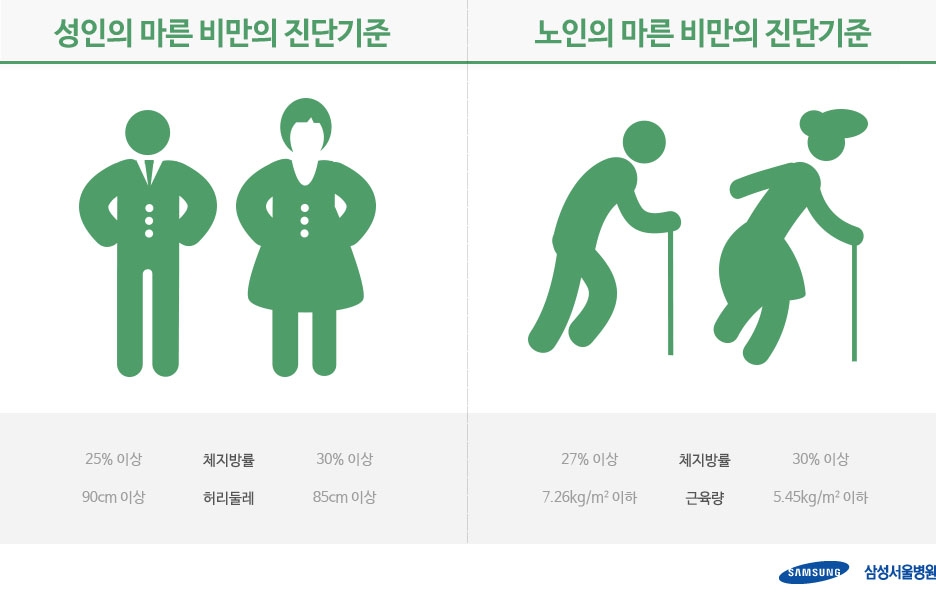 "근육 없는 'ET형 몸매', 당뇨병 위험 57% 높다"