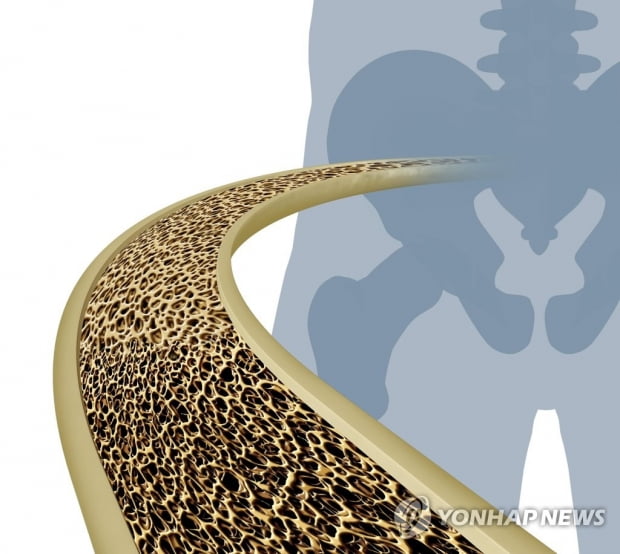 Fractures as a child Signs of risk of fractures and osteoporosis in old age