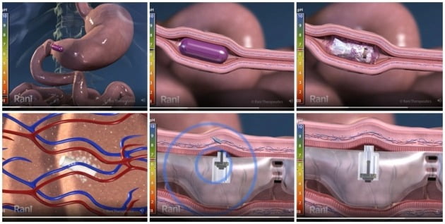 라니필의 작용 기전(왼쪽 첫 번째 사진부터 시계방향 순으로 작동) / 사진=라니테라퓨틱스 홈페이지