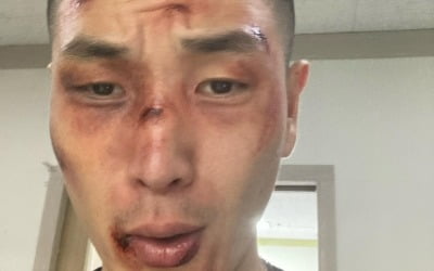 '방탄소년단 디스' 비프리, '장애인 시위' 막는 경찰 비판