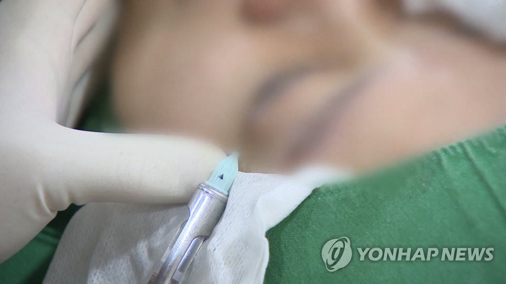 [위클리 건강] 연휴·방학에 시력교정술 할까…"꼼꼼한 장단점 체크부터"