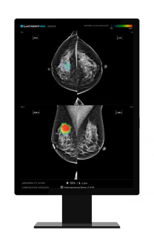 유방촬영술 영상분석 솔루션 ‘루닛인사이트MMG’. 사진 제공=루닛