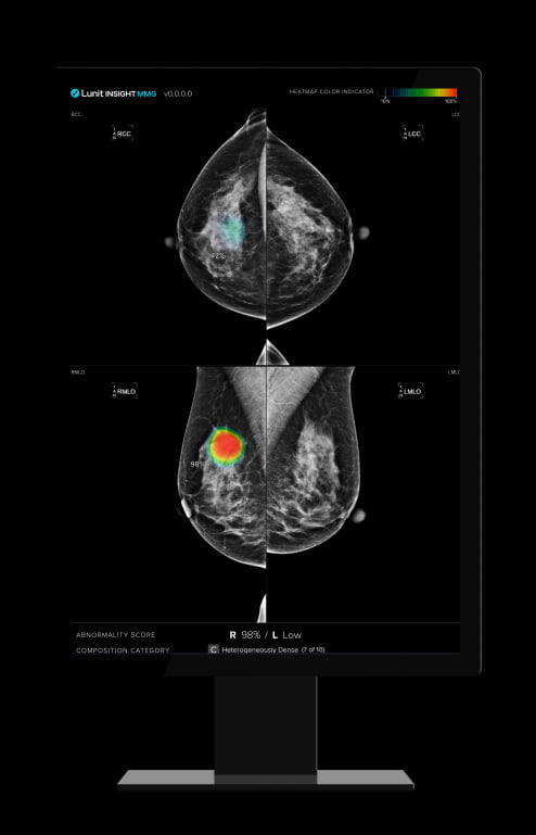 △루닛 유방촬영술 AI 영상분석 솔루션 '루닛 인사이트 MMG'

