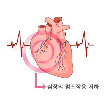"안트라사이클린 항암제, 장단기적 심부전 위험↑"