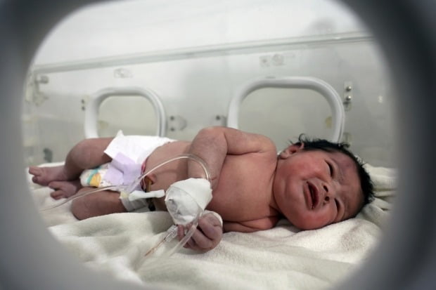 시리아 강진 피해 현장에서 구조된 뒤 병원에서 치료받고 있는 당시 아기의 모습. /사진=연합뉴스