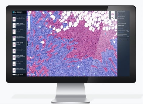 루닛 AI 바이오마커 '루닛 스코프 IO(Lunit SCOPE IO)'/사진제공=루닛