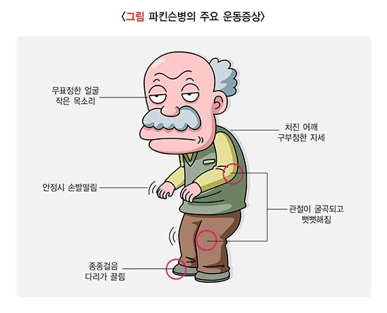 [위클리 건강] "노년의 적 파킨슨병…한국인 위험요인 1위는 운동부족"