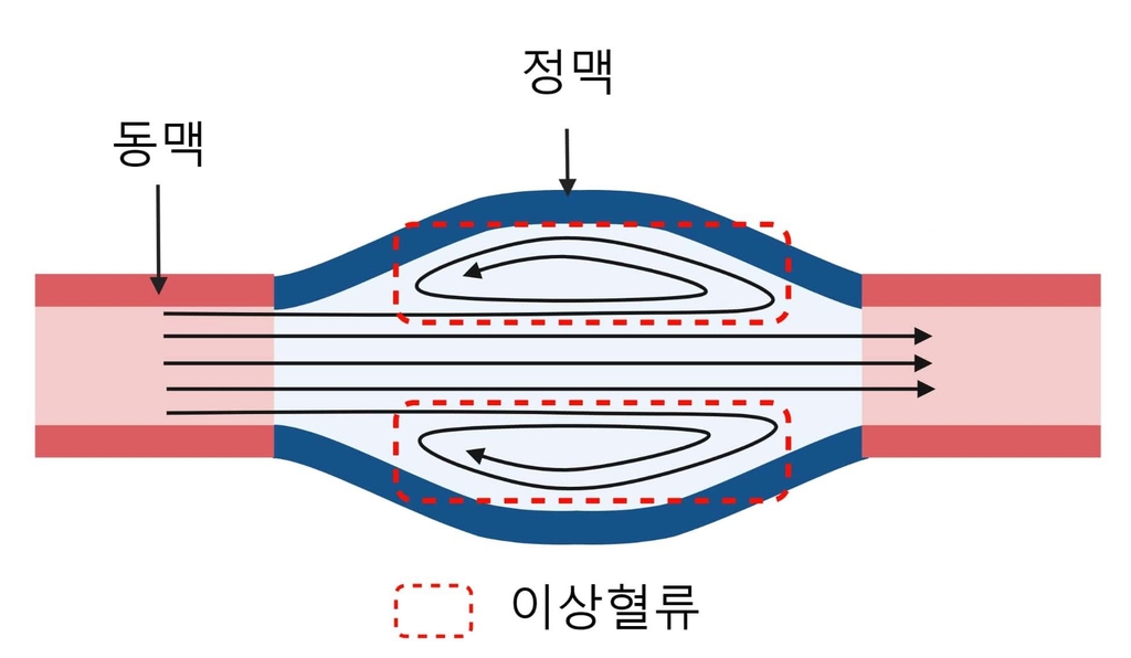 "혈관 협착 막는 투석혈관용 기기 개발…동물실험서 효과"