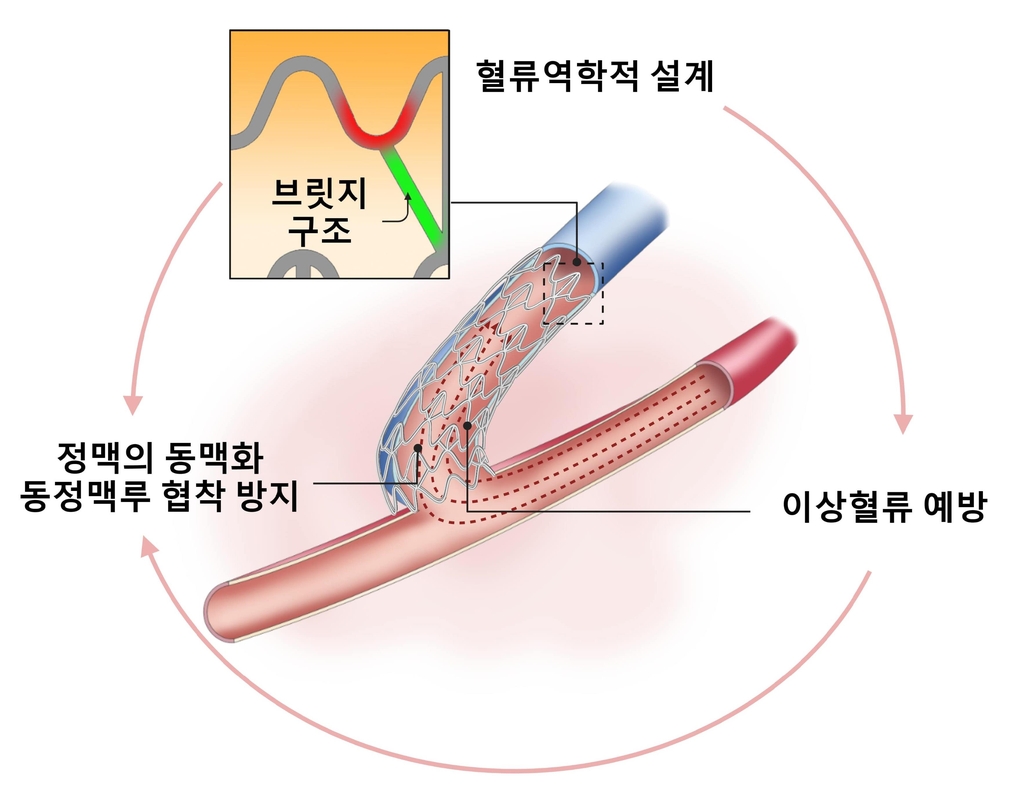 "혈관 협착 막는 투석혈관용 기기 개발…동물실험서 효과"