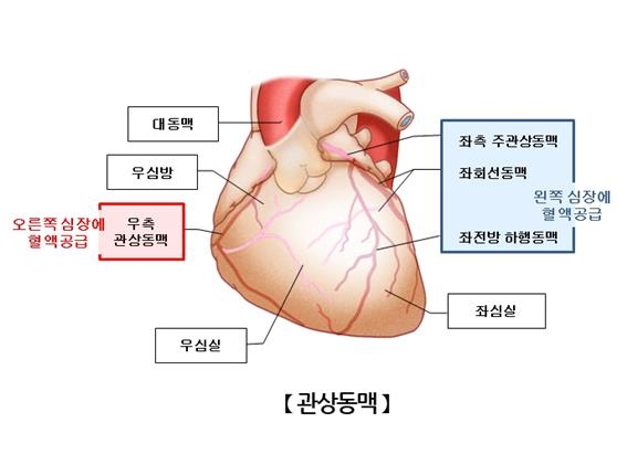 "임신합병증 전력, 관상동맥 질환 위험↑"