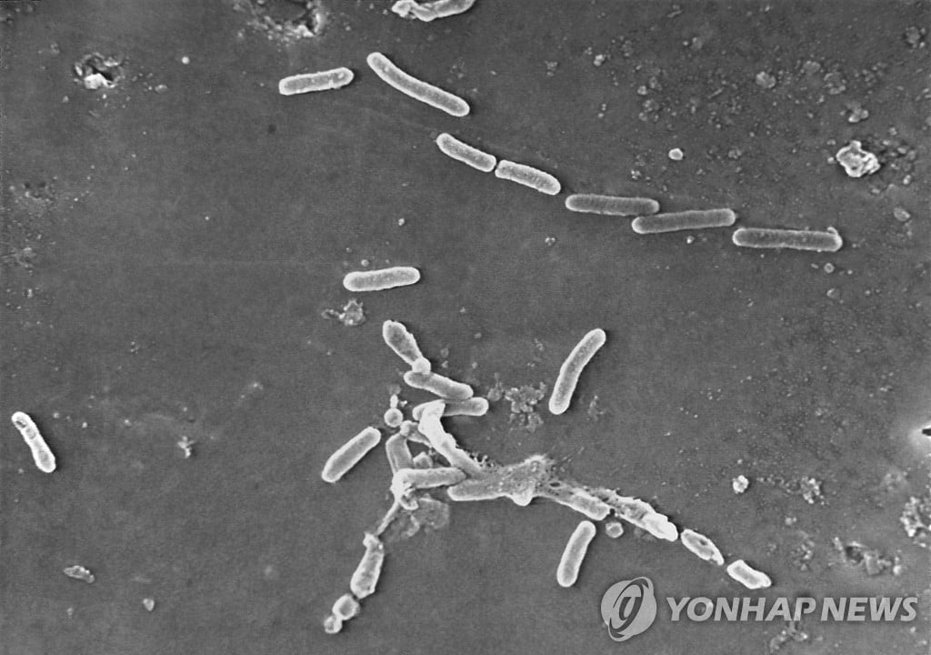 죽거나 안구적출까지…美 '공포의 인공눈물' 발칵