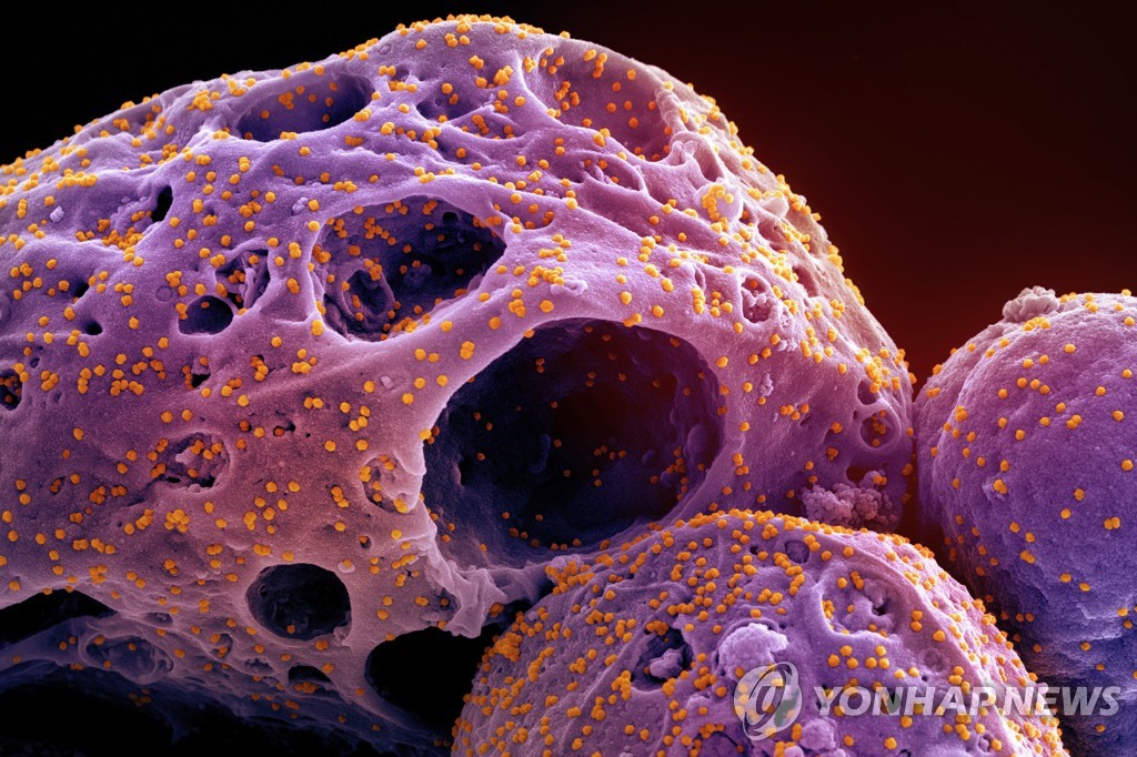 코로나19 기원은…WHO, 전세계에 '제보해달라' 촉구