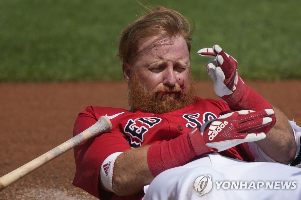 [고침] 스포츠(MLB 터너, 얼굴에 투구 맞고 16바늘 봉합……)