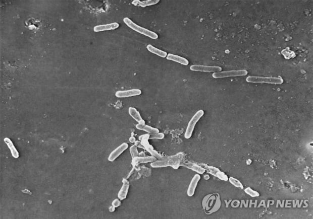 '공포의 인공눈물'…美서 3명 사망·4명은 안구 적출