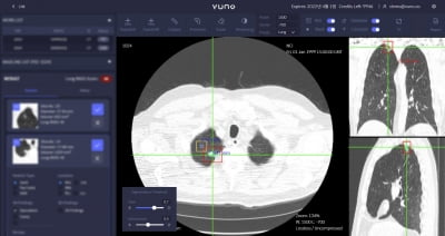 뷰노, AI 기반 의료영상 분석 기술 美 특허 등록