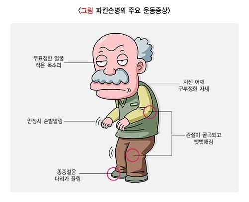 "파킨슨병, 재활치료 빠를수록 인지기능 개선 효과 커"