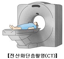 "18세 이전 잦은 CT, 암 위험↑"