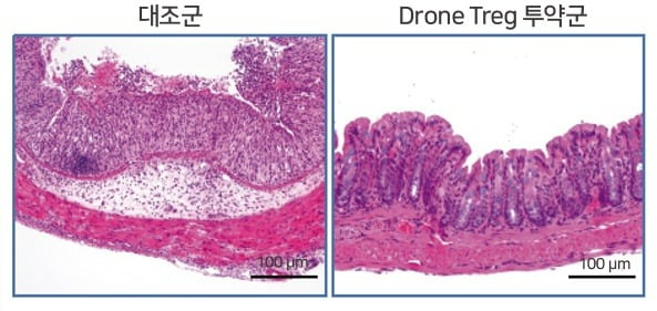 염증 유도에 의해 망가진 대장 조직(좌측)과 Drone Treg 세포치료제에 의해 복구된 대장 조직(우측)의 조직병리 사진./자료 제공=지아이셀