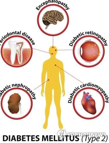 "전세계 당뇨 환자 2050년까지 13억명으로 갑절 된다"