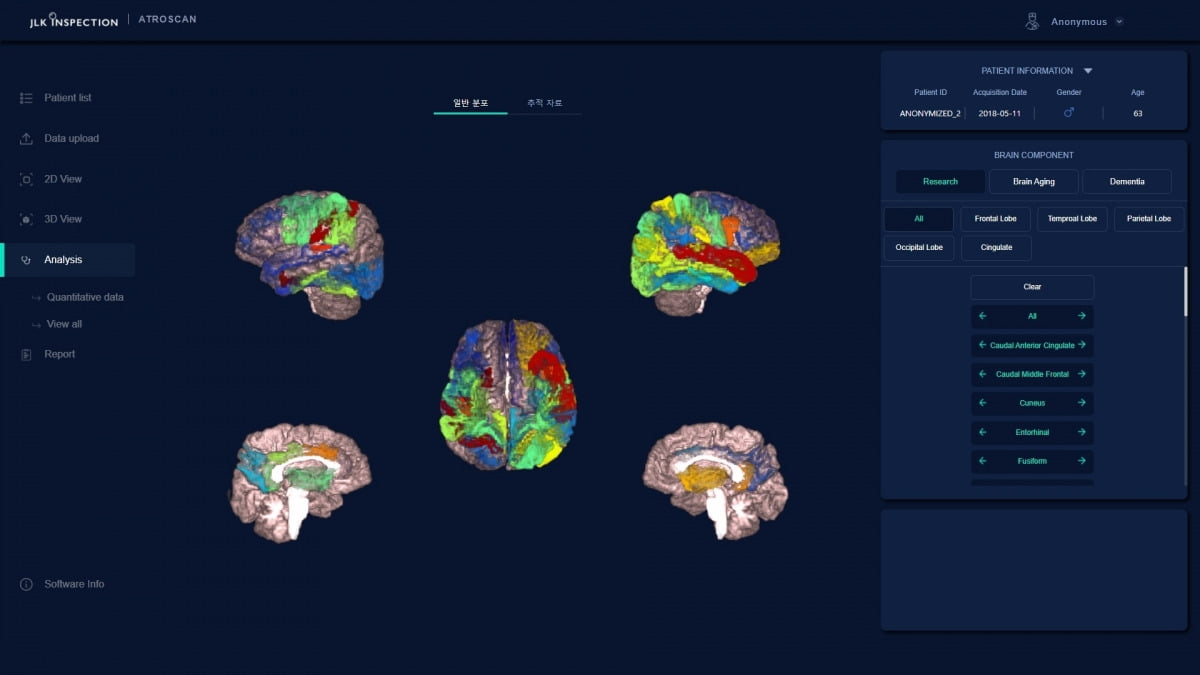 제이엘케이 인공지능(AI) 기반 뇌 노화 치매 분석 솔루션 에이트로스캔.  /사진=한경DB