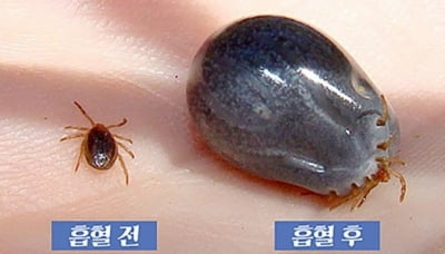 진드기 물린 환자 사망…"길고양이 때문 아니야" 반박도