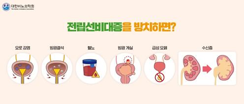 [위클리 건강] "50대이상 절반이 전립선비대증…방치하면 방광 망가질 수도"