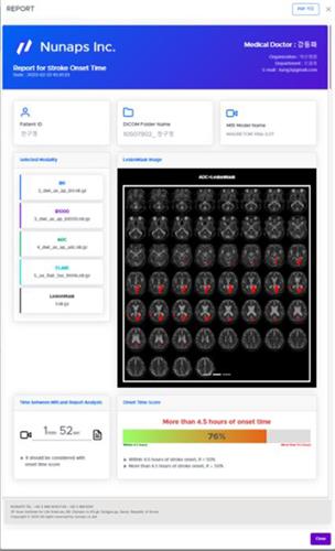 뇌경색 진단보조·시지각 훈련 소프트웨어 혁신의료기기 지정