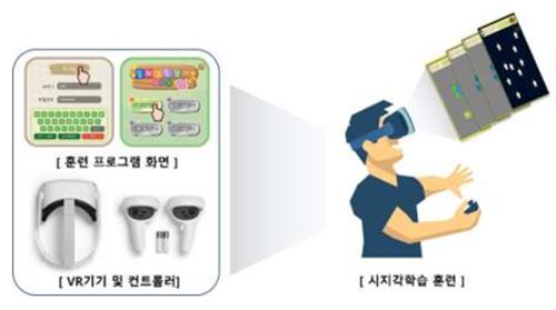 뇌경색 진단보조·시지각 훈련 소프트웨어 혁신의료기기 지정