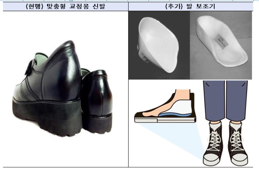 장애 아동·청소년 '발 보조기' 건강보험 적용…최대 90% 지원