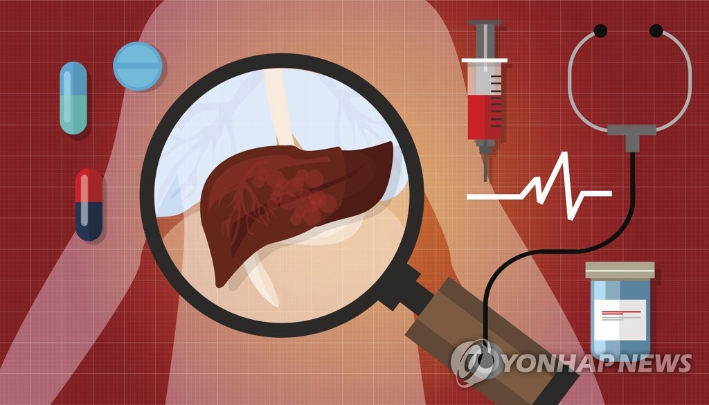 "똑같이 술 마셔도 혈당 높을수록 간암 위험도 크다"