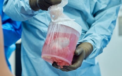 '돼지 신장' 이식 받은 50대 뇌사자…32일 넘게 정상기능 [헬스케어 인사이드]