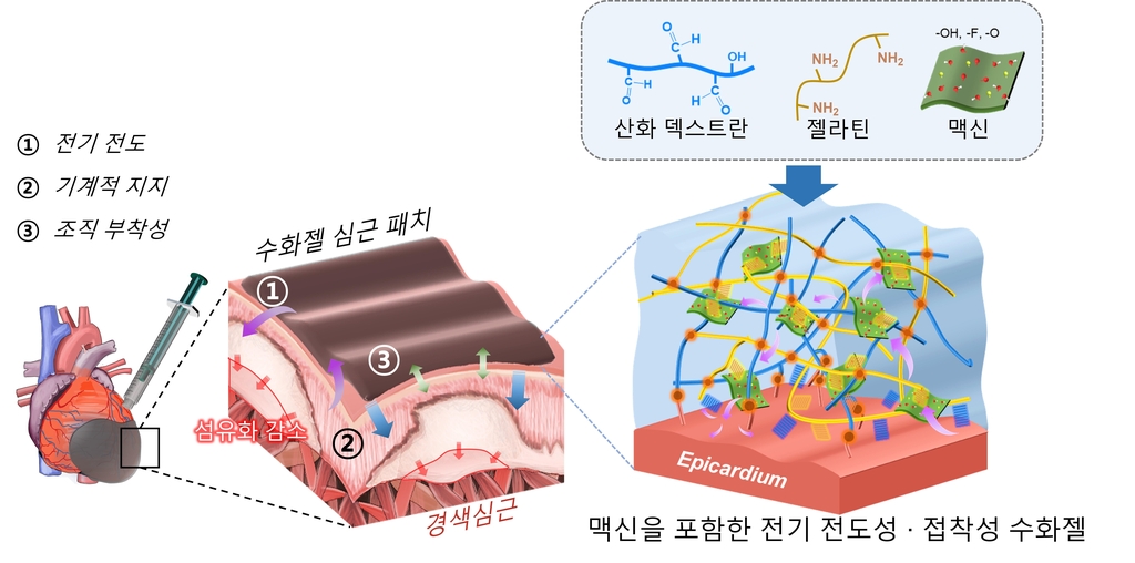 지스트·전남대, '심장에 젤 발라 심근경색 치료' 패치 개발